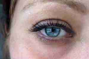 how to get rid of dark eye circles